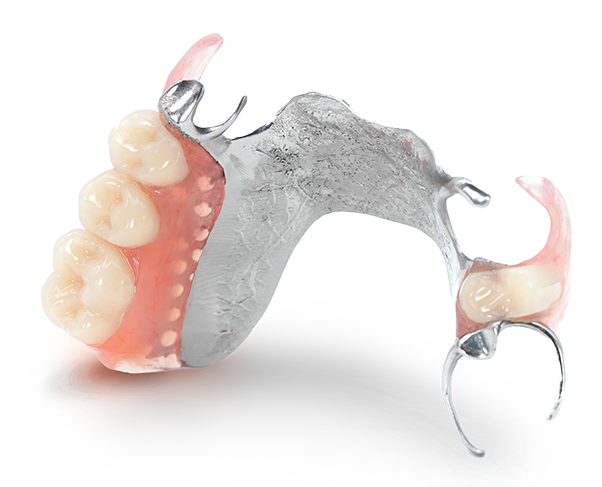 パーシャル デンチャー Die partielle Prothese パーシャル デンチャー Die partielle Prothese パーシャル デンチャー